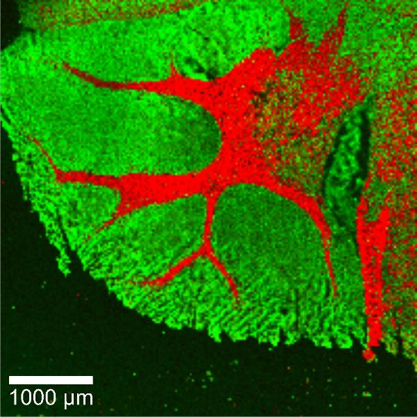 Confocal Raman image of a hamster brain tissue.