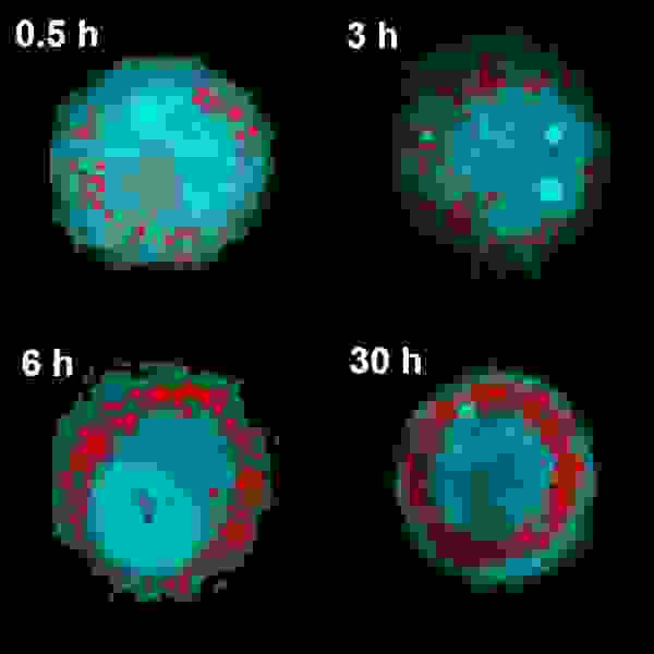 Lipid droplets in macrophage