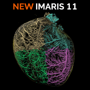 Try the new release of Imaris now