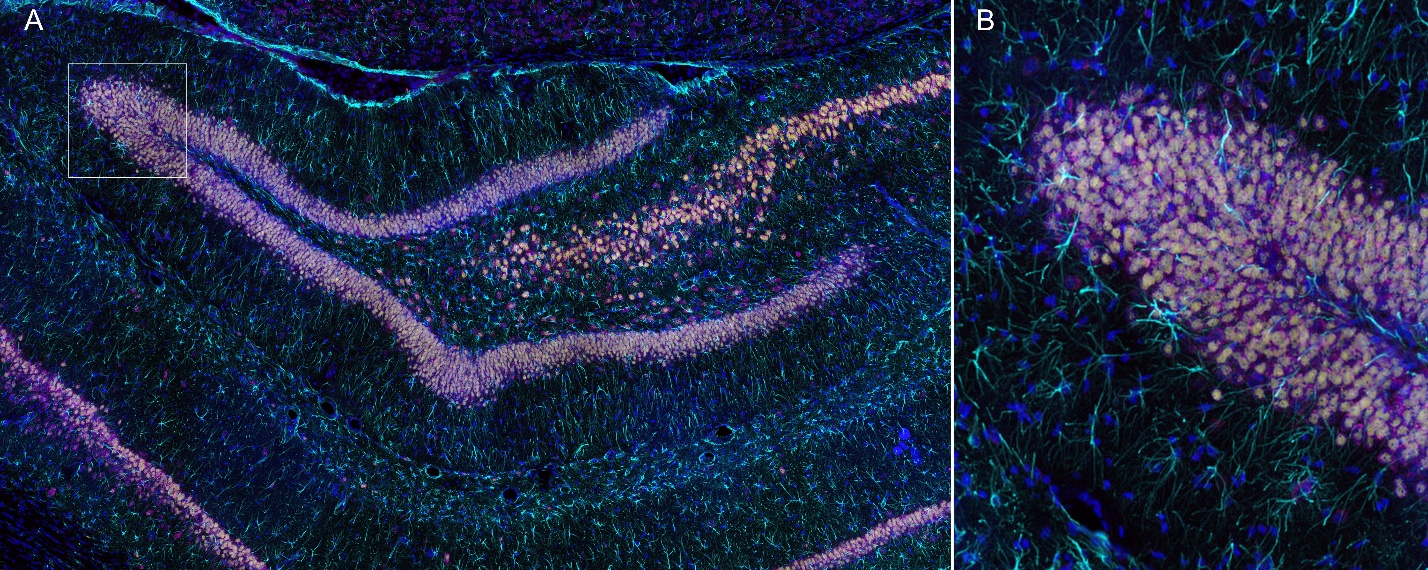 Large-scale imaging of rat hippocampus using confocal microscopy with sCMOS detector