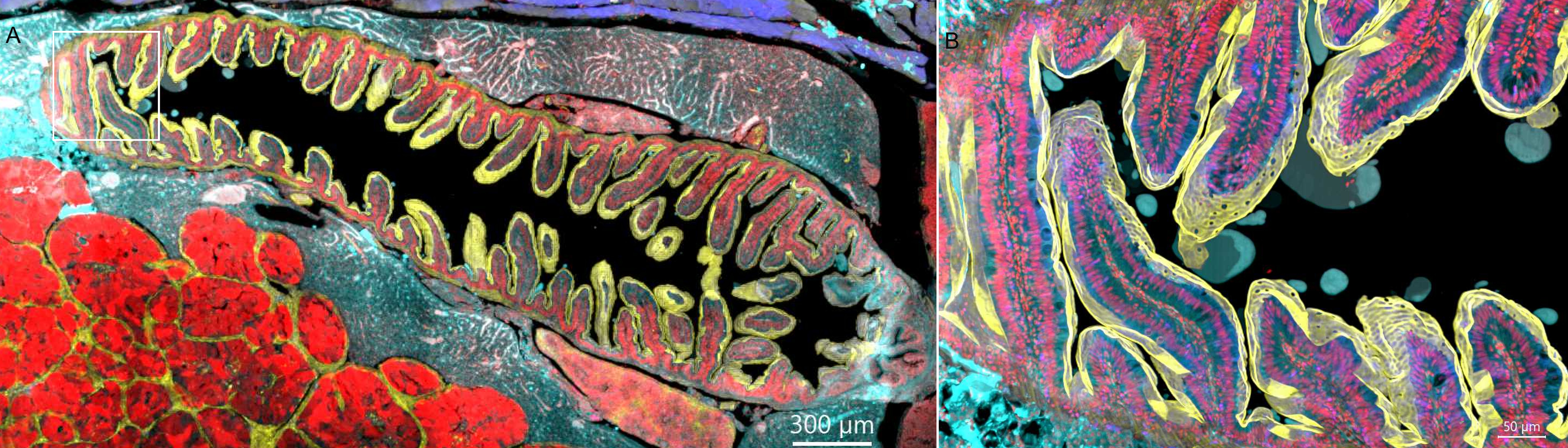 Zebrafish Intestine